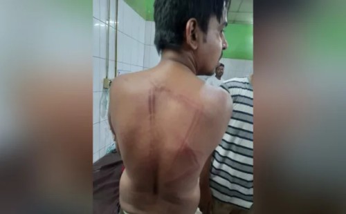 সিন্ডিকেটের প্রতিবাদ করায় দুই সাংবাদিককে পেটালেন আ. লীগ-বিএনপি নেতারা 