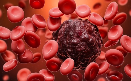 ব্লাড ক্যান্সার কেন হয়, বাঁচতে করণীয় 