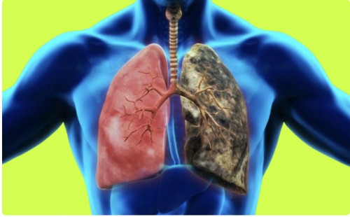 শীতকালে হাঁপানি থেকে দূরে থাকার উপায় 