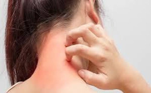 এলার্জি থেকে দূরে থাকতে যা করবেন 