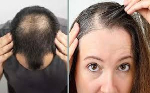চুল পড়া কমাতে যা করবেন: ঘরোয়া যত্নেই মিলতে পারে সমাধান 
