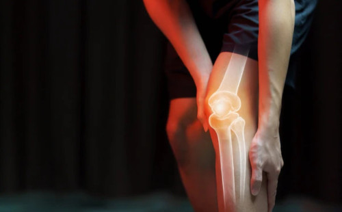 যেসব কারণে অল্প বয়সে বাড়ছে হাঁটুর ব্যথা, জানুন করণীয় 